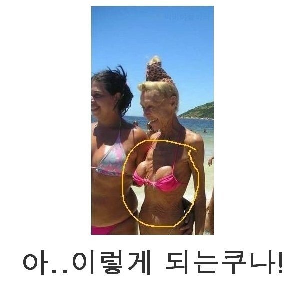 가슴수술 나이들면 이렇게 된다.jpg